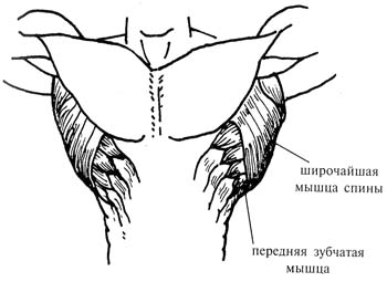 Упражнения на широчайшие мышцы